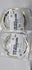 4339432410-DOUBLE CONE ASSY(4&6)